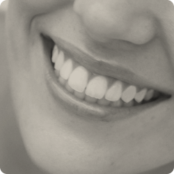 Fraundorfer Dentistry Teeth Whitening